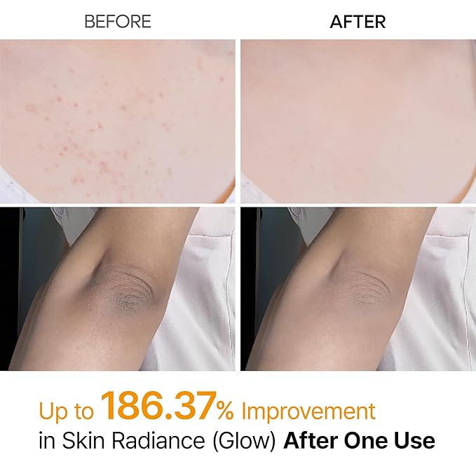 Dr.Melaxin Peel Shot Kojic Acid Turmeric Body Exfoliator Spray 6.76 fl.oz - AHA PHA Niacinamide Body Scrub for KP Bumps, Dark Spots, Uneven Skin Tone, Dead Skin, Korean Skin Care