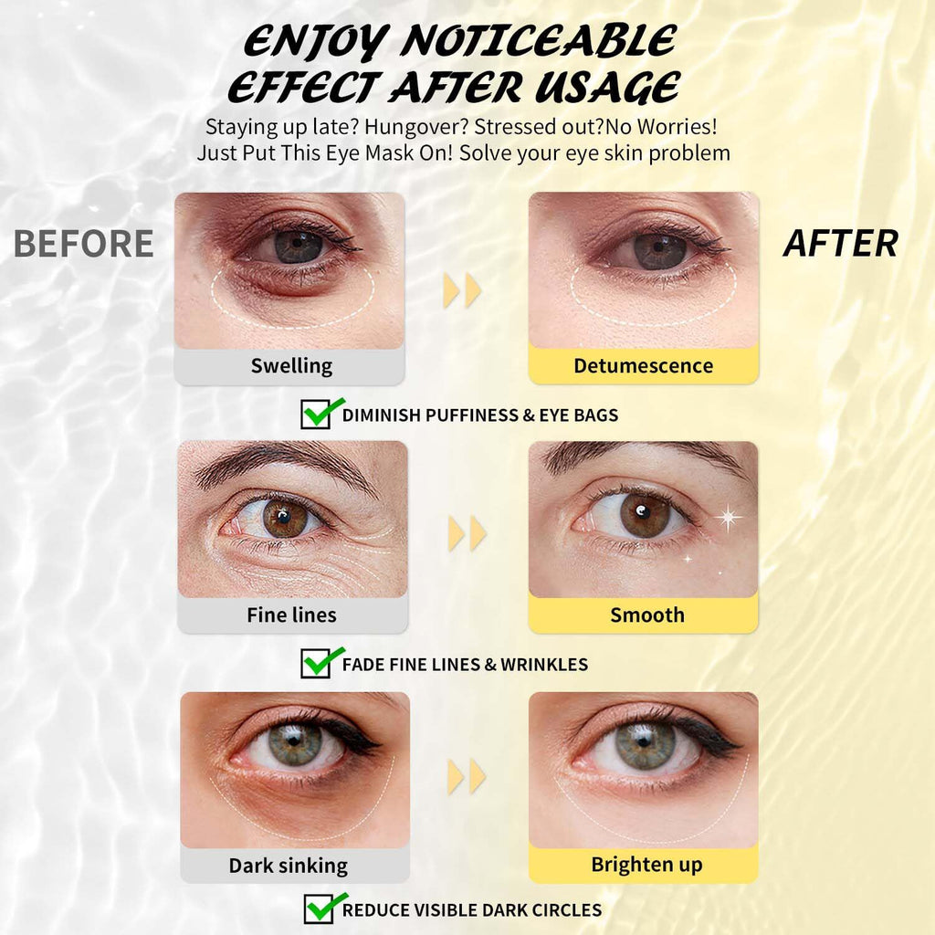 Maskiss Retinol Under Eye Patches (24 Pairs), Lavender Purple Eye Masks for Dark Circles, Puffy Eyes & Wrinkles, Firming Collagen Eye Patches, Vegan Cruelty-Free Skincare Gifts for Women