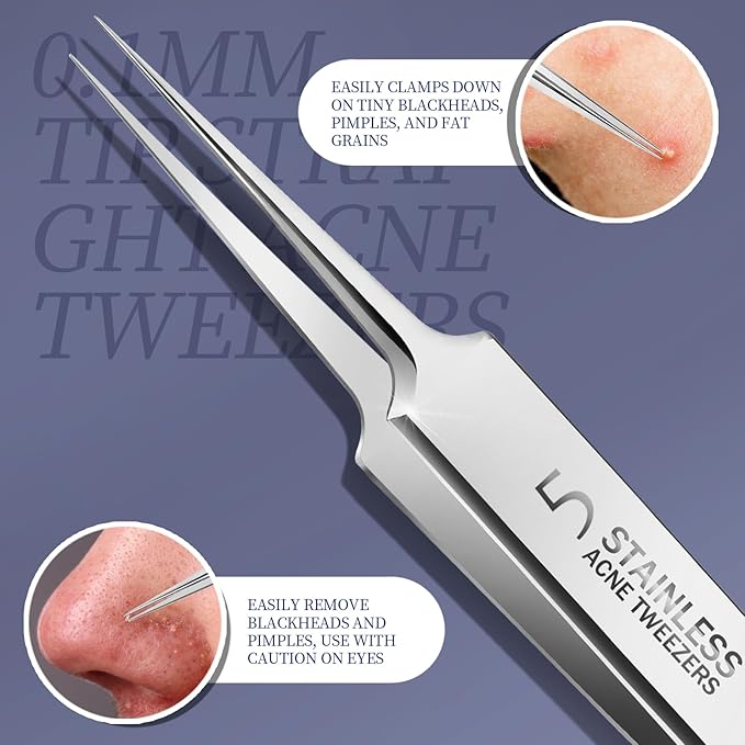 Teenitor 7 Pcs Pimple Popper Tool Kit, Surgical Grade Blackhead Remover Tools, Ingrown Hair Tweezers, Blackhead Extractor Pimple Extractor, Black Head Remover