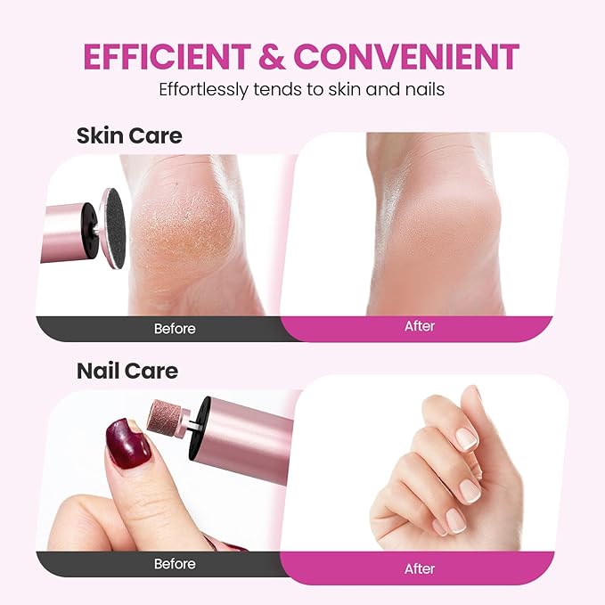 Electric Foot Callus Remover, 2 in 1 | 6 Speed Adjustable Foot File Nail Grinder with Sandpaper Disks, Professional Sander Pedicure Tool for Feet Dead Skin, Self Care Gifts for Women Mom Lover Friends