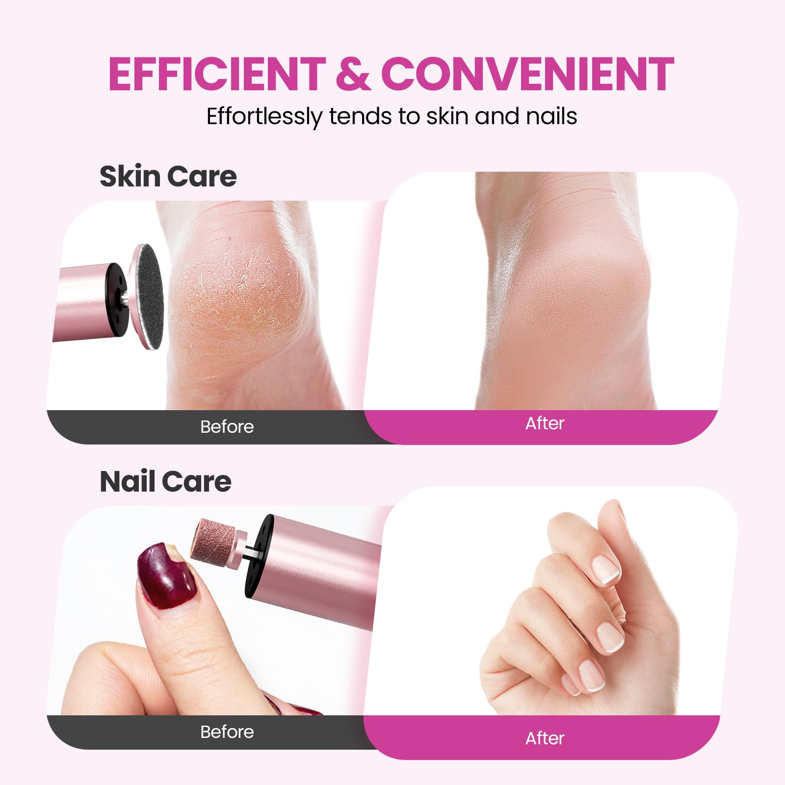 Electric Foot Callus Remover 6 Speed Adjustable for Women Mom Lover