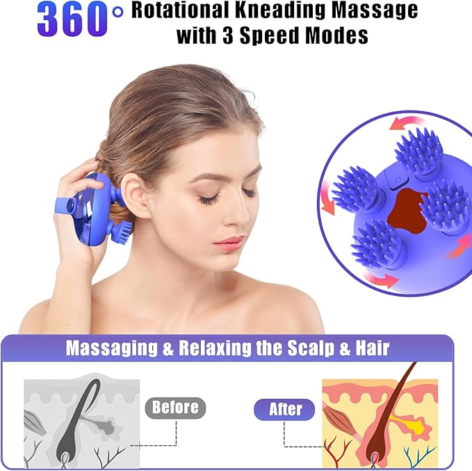 Viuyougor Scalp Massager Electric, Portable Scalp Massager Tool, Waterproof Head Massage Stress Relax, Hair Massagers with 3 Speed Modes & 8 Massage Claws