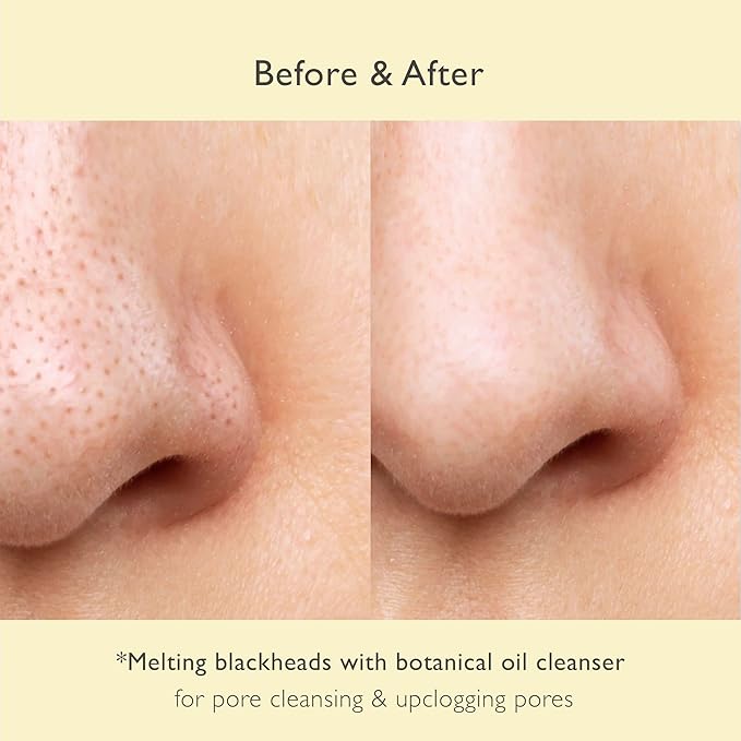 NOWATER Korean Cleansing Oil for Double Cleansing – Makeup Remover & Pore Cleanser with 30% Olive Oil, Tea Tree, Squalane, Blackhead Dissolving Facial Oil for All Skin Types, (6.76 fl.oz)