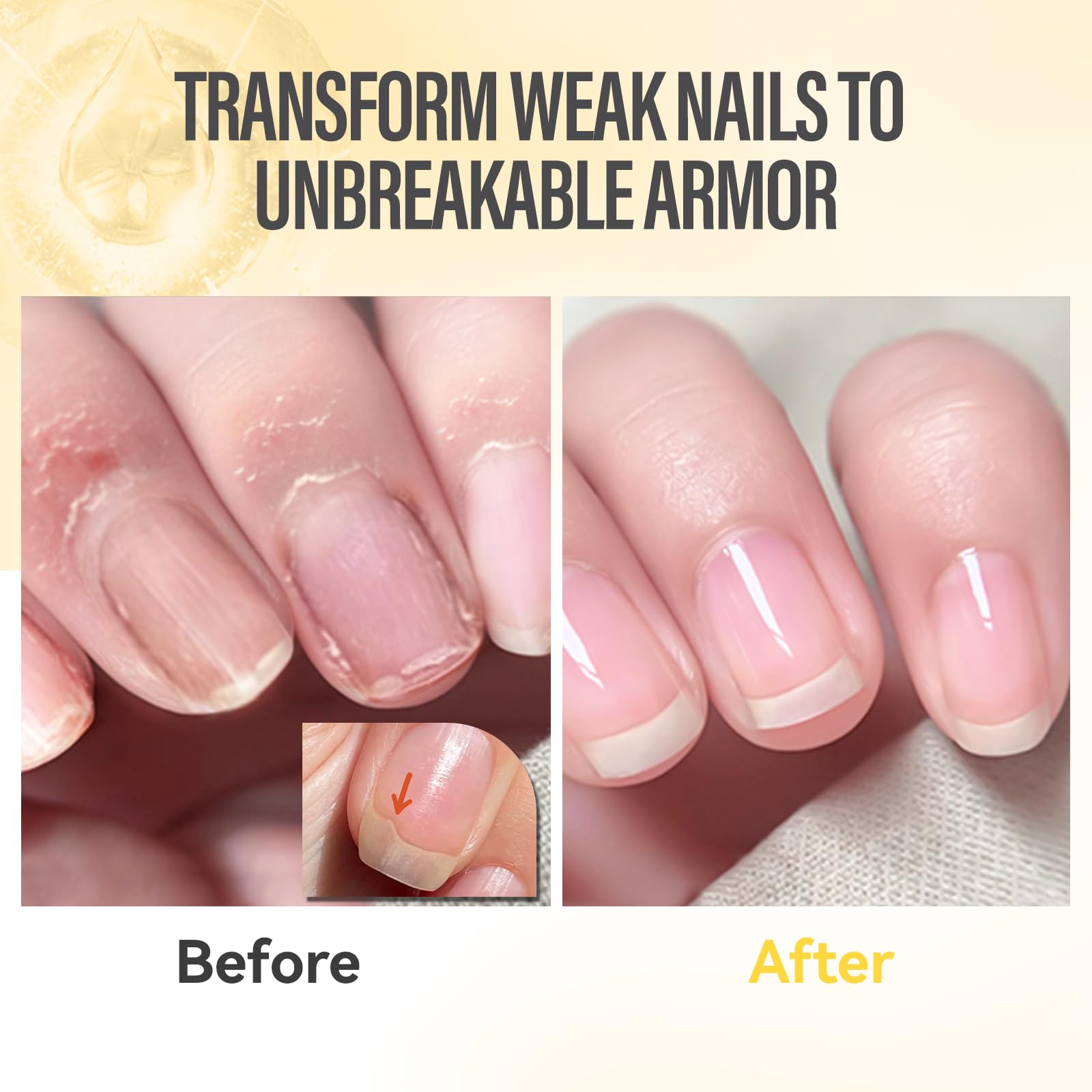 CHUCHU Vegan Cuticle Oil for Nails: Orange Jojoba Nail Cuticle Oil with Vitamin B & E for Moisturizes Cuticle and Nail's Skin - Prevents Hangnails and Chapped 15ML