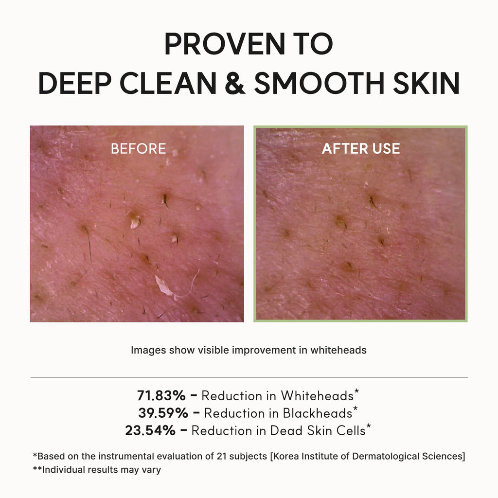 Arencia Korean Rice Mochi Face Cleanser - Face Wash, Gentle Scrub All in One for Deep Cleansing, Moisturizing, Pore Minimizing with Rice Water & Green Tea (4.23oz)