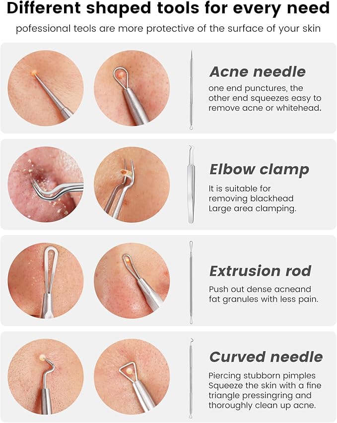 Pimple Popper Tool Kit - Boxoyx 6 Pcs Pore Prep Blackhead Remover Comedone Extractor Kit with Box for Quick and Easy Removal of Pimples, Blackheads, Zit Removing, for ehead,Facial and Nose (Silver)