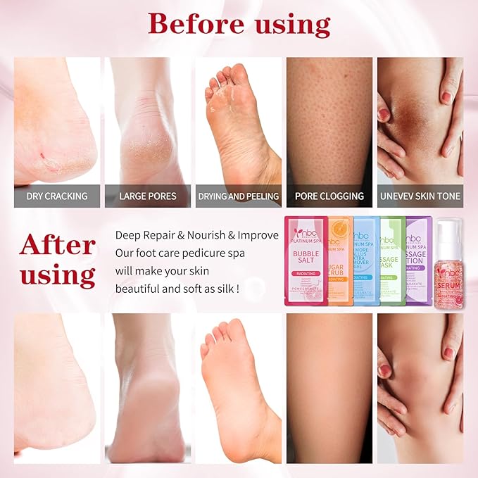 nbc BeautiLab Pedicure Foot Soak Set - Upgraded 6 in 1 Foot Spa, Foot Bath Spa, Pedicure Kit, Foot Soak for Tired & Dry Cracked Feet, Athletes Feet and Calluses (Pomegranate)