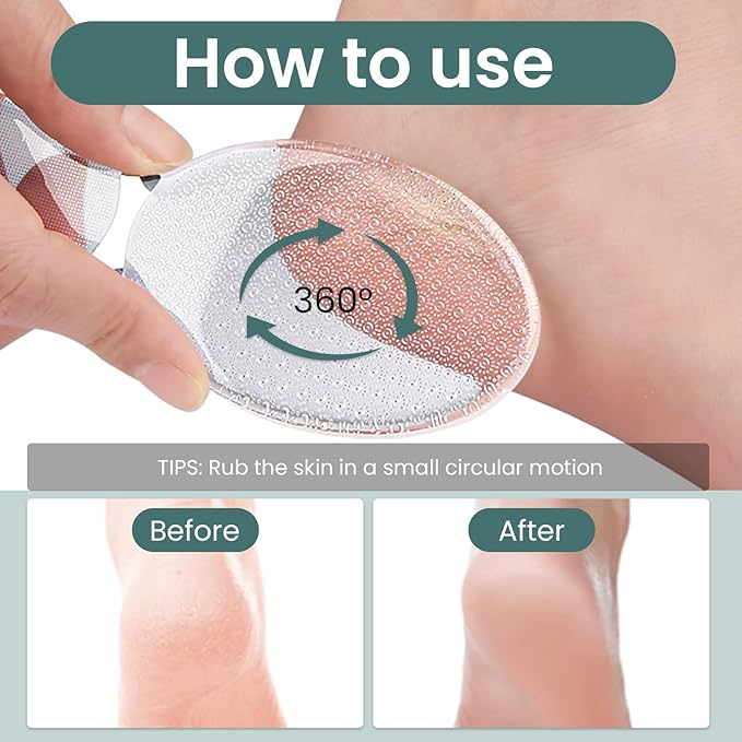 ESUOHYM Glass Foot File Callus Remover Dead Skin Feet Heel Scraper