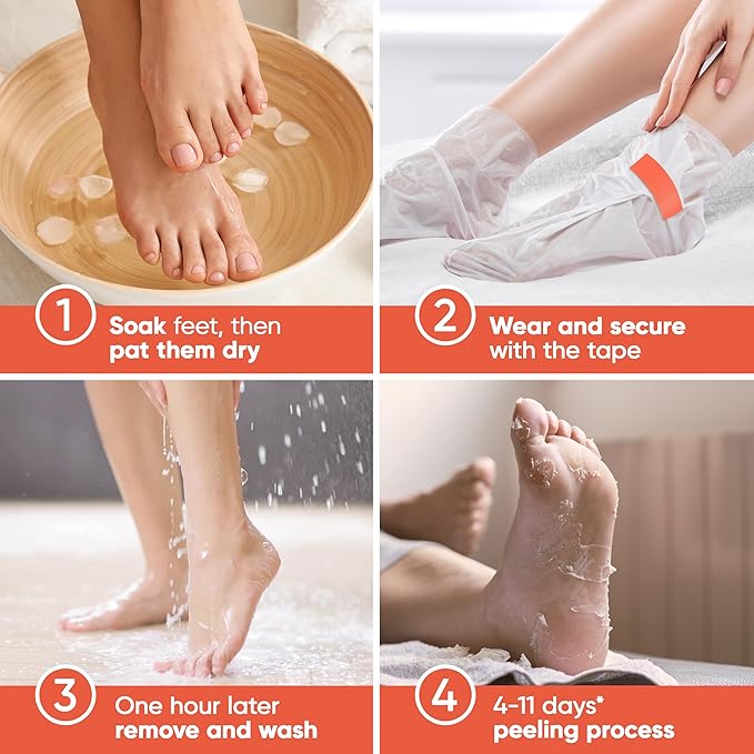 CÉLOR Foot Peeling Mask for Dry Cracked Feet | Foot Mask to Exfoliate Rough, Cracked, Dry Feet, Calluses for Soft Baby Feet Results | Made with Aloe Vera Extract for Women & Men (2 Pairs) | Peach