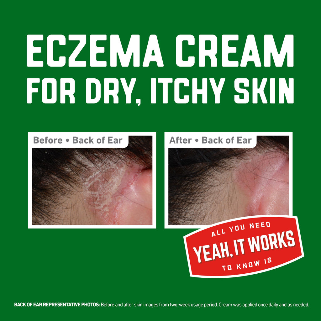 O’Keeffe’s Skin Repair Eczema Relief Body Cream, 7oz Tube (Pack of 1)