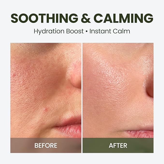elravie HyCicaMue Green Face Mist | Ultra-Fine Face Spray for Instant Calming & Moisturizing | Cica, Peptide, Ceramide, Hyaluronic Acid | Reduce Excess Sebum & Soothe Irritated Skin | Korean Skin Care