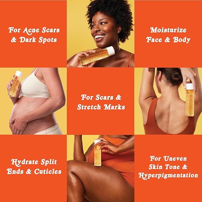 Bio-Oil Fragrance-Free Body Oil Serum for Scars & Stretch Marks, 4.2 fl oz