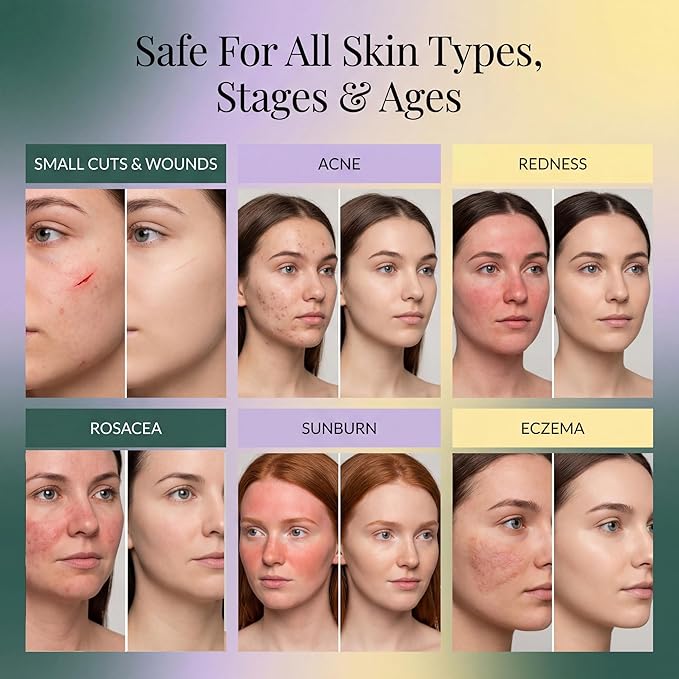 Jusspray™ Hypochlorous Acid Spray for Face and Skin | HOCI Facial Cleanser Mist | 4 oz Hypochlorous Acid for Face, Skin, Acne, Eczema, Body Acne Sprays, Piercing Aftercare, Wound Solution