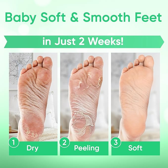 Foot Peel Mask - Foot Mask for Baby Soft Skin - Remove Dead Skin, Dry, Cracked Feet & Callus, Foot Spa, Made with Aloe Vera Extract for Women and Men (2 Pairs, Peppermint)