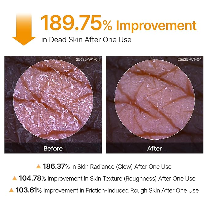 Dr.Melaxin Peel Shot Kojic Acid Turmeric Body Exfoliator Spray 6.76 fl.oz - AHA PHA Niacinamide Body Scrub for KP Bumps, Dark Spots, Uneven Skin Tone, Dead Skin, Korean Skin Care