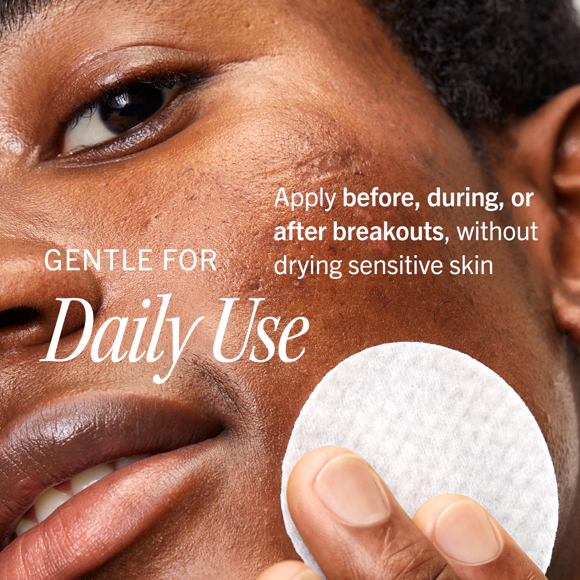 First Aid Beauty Acne Treatment Pads, 2% Salicylic Acid, 60 ct