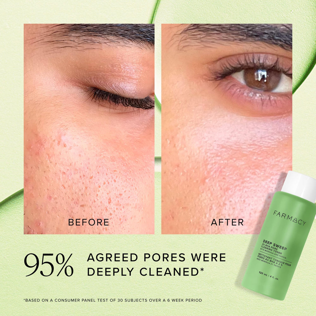 Farmacy 2% Salicylic Acid Toner for Face - Deep Sweep BHA Liquid Exfoliant + Pore Cleaner - Controls Oil, Gently Exfoliates + Refines Pores - Skin Care for Combo, Oily + Blemish-Prone Skin - (50ml).