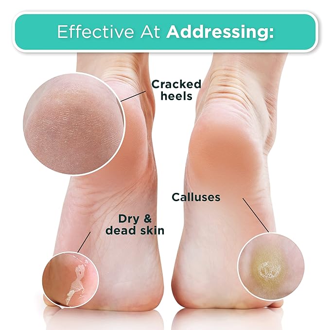 DERMORA Foot Peel Mask | Skin Exfoliating Foot Masks for Dry, Cracked Feet & Callus Removal | Dead Skin Exfoliator for Baby Soft Feet | Pack of 2 | Regular (Fits up to Men 10 / Women 11) | Tea Tree