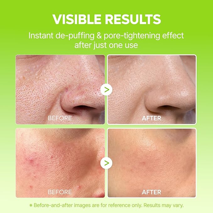 Dr.Melaxin Cactox Pore Relief Jelly Serum Mist, Instant Cooling Face Mist for Pore Tightening & De-Puffing, Hydrating Cactus Serum for Puffy Skin, 80ml (2.7 fl oz)