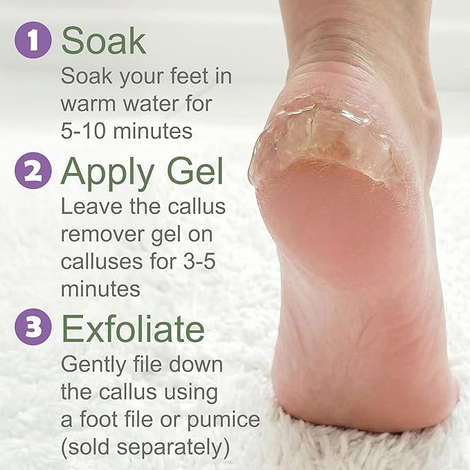 Callus Remover for Feet (Extra Strength 8 oz) Foot Callus Remover Gel, Spa Foot Care, Pedicure Tools for Feet Scrubber
