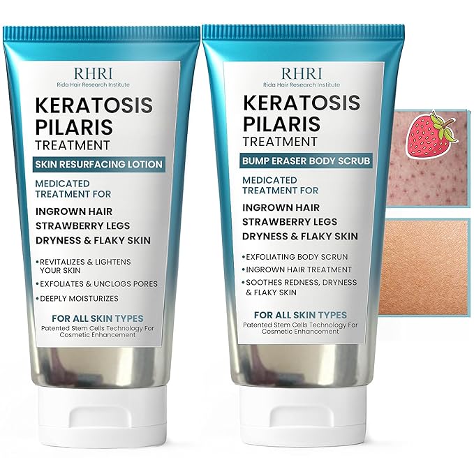 KP Bump Eraser Body Set with 10% AHA | Keratosis Pilaris Treatment | Keratosis Pilaris Lotion | Exfoliating Body Scrub | Bundle Set for Bump, Strawberry Legs, Redness, Dryness