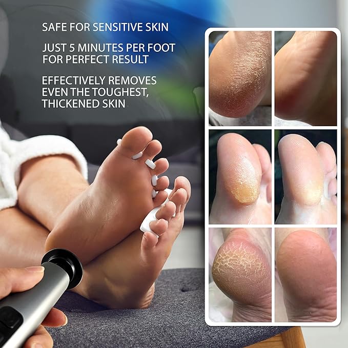 Electric Foot Callus Remover – Rechargeable Metal Foot File for Dead Skin & Cracked Heels – 9 Speed Professional Pedicure Tools with 60 Sanding Discs – Powerful Heel Scraper for Feet, Black