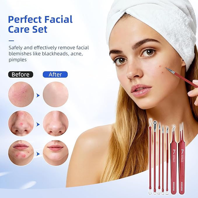 Shevelestar 7PCS Blackhead Remover Tools, Pimple Extractor, Rose Red