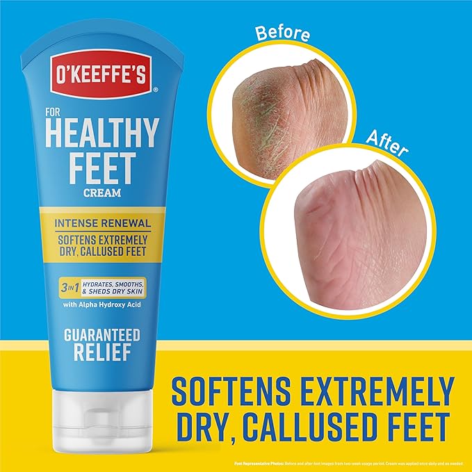 O'Keeffe's for Healthy Feet Intense Renewal Cream with Urea & Alpha Hydroxy Acid - 3 oz Tube (1 Pack) - Chemically Exfoliates and Softens Extremely Callused, Dry Feet