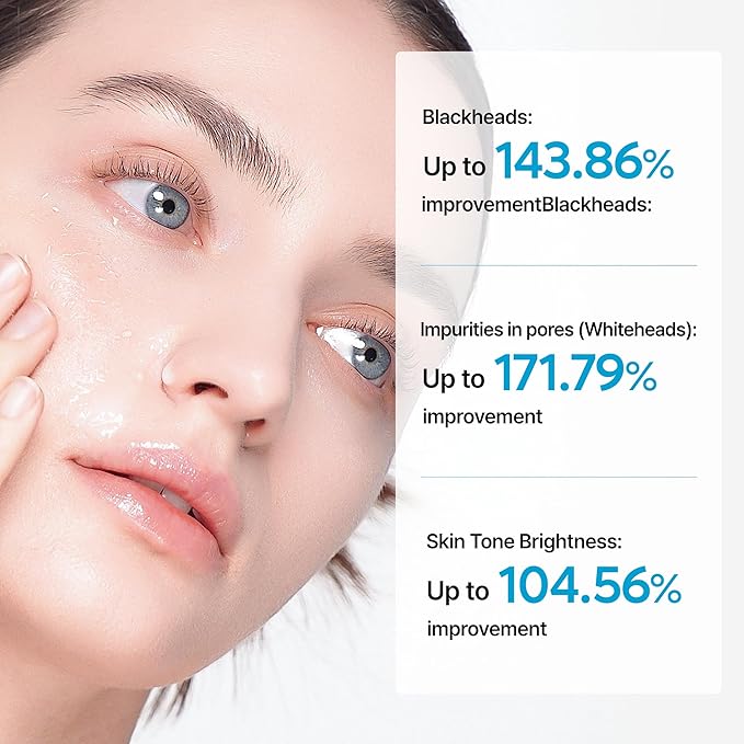 Dr.Melaxin Peel Shot Exfoliating TX Serum 80ml – 99% Pure Tranexamic Acid & Niacinamide + AHA PHA Brightening Exfoliating for Uneven Skin Tone, Dark Spots & Dullness | Smooth | Korean Skincare