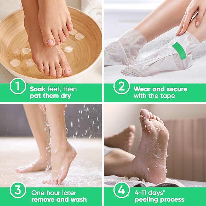 Foot Peel Mask - Foot Mask for Baby Soft Skin - Remove Dead Skin, Dry, Cracked Feet & Callus, Foot Spa, Made with Aloe Vera Extract for Women and Men (2 Pairs, Peppermint)