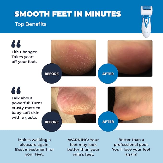 Electric Callus Remover: Rechargeable Electronic Foot File CR900 by Own Harmony (Powerful Motor) Best Pedicure Tools w 3 Rollers Professional Pedi Feet Care Sander for Cracked Heels and Hard Skin