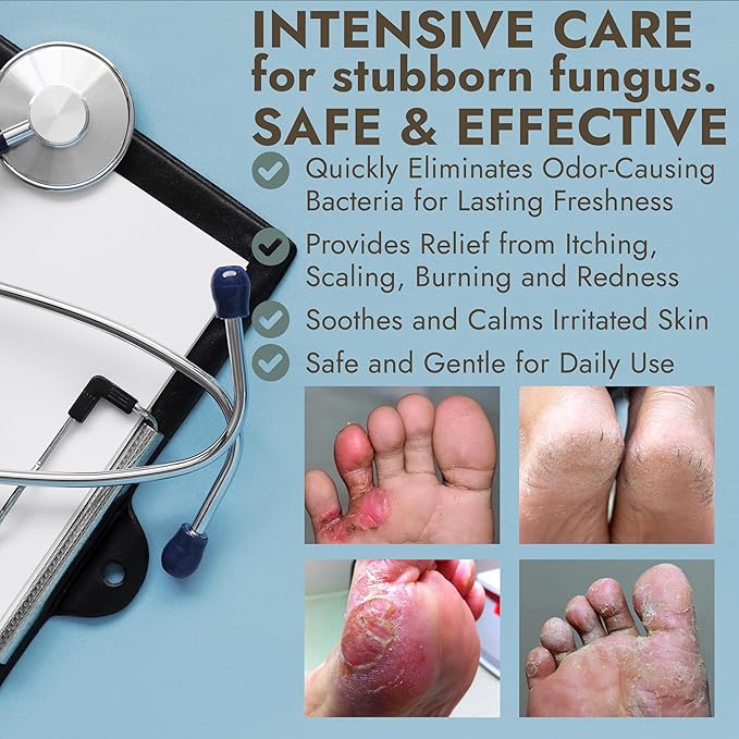 Antifungal Foot Powder with Miconazole Nitrate 2% & Tea Tree Oil for Foot Fungus Treatment | Soothes Itchy Skin, Controls Odor & Prevents Reinfection | Antifungal Powder for Athlete’s Foot | 3 of 3