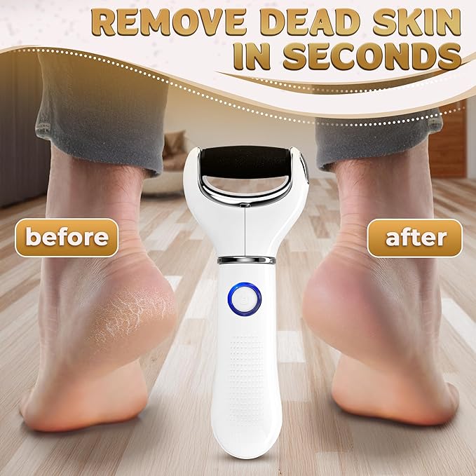 Electric Foot File Callus Remover – 3-Speed Foot Scrubber Electric (1800/2200/2800 RPM), Dry Skin Remover for Feet – 2 Replacement Rollers 80 & 60 Grit, 360° Precision Control & Easy-to-Clean Design