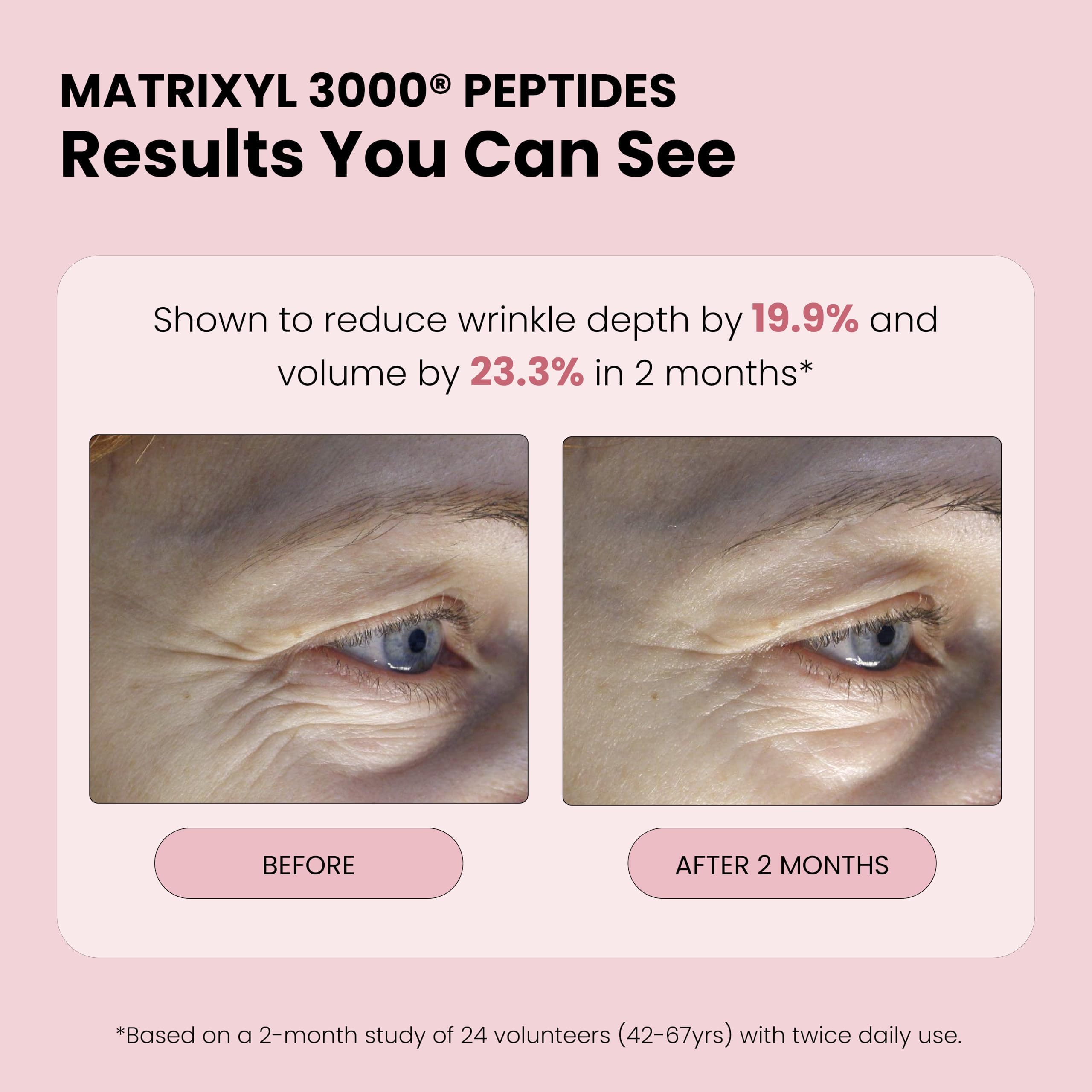 Simplified Skin Rose Water Spray for Face with Matrixyl 3000 & Glycerin