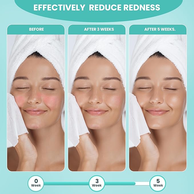 Disposable Face Towel Travel Pack – XL 10"×12" Face Towelettes Disposable, Ultra-Soft & Thick Travel Face Wipes for Sensitive Skin, Makeup Remover Dry Wipes, 15 Towels per Pack – Visfresh (3 Packs)