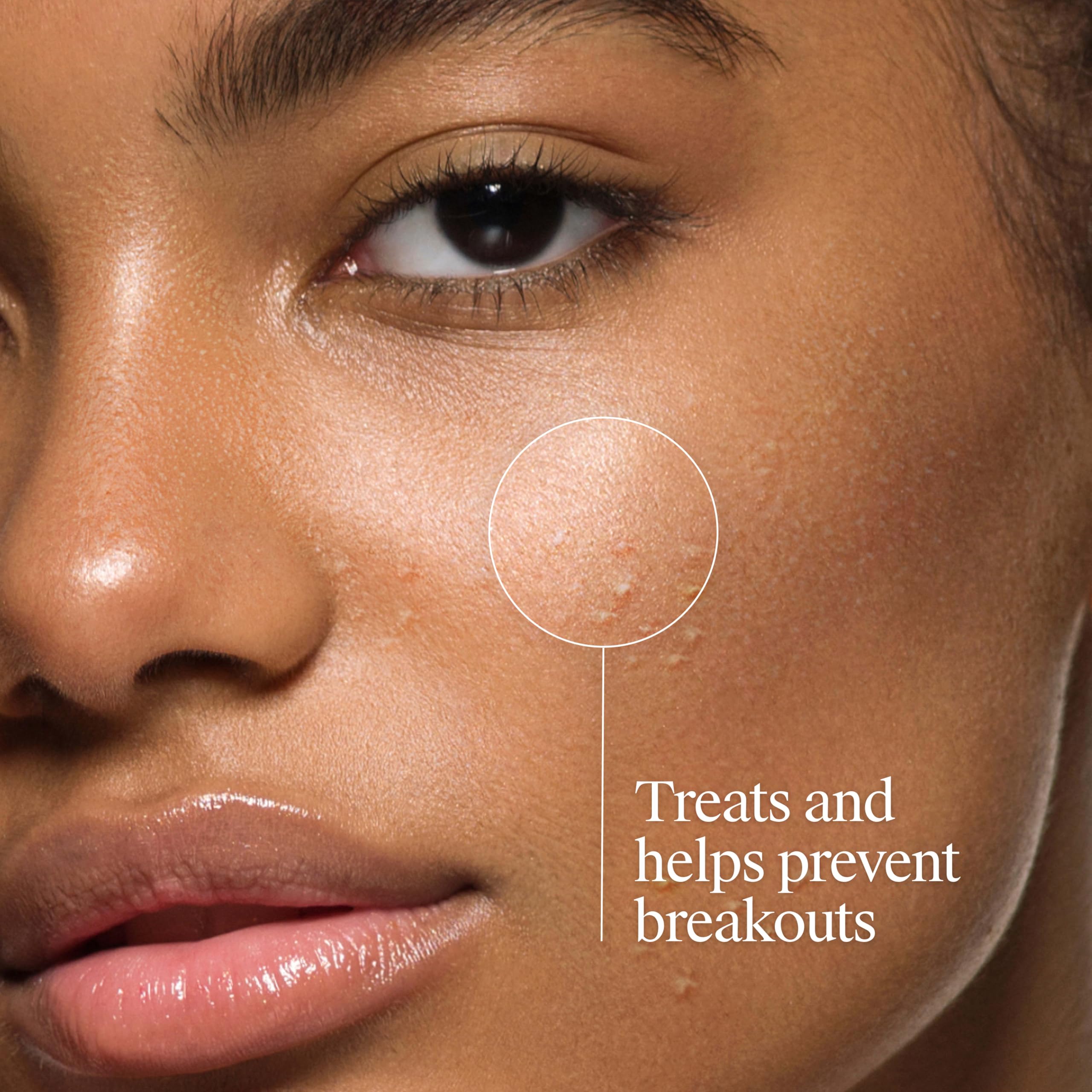 Neutrogena Oil Free Acne Face Wash, Fragrance Free, 9.1 fl oz
