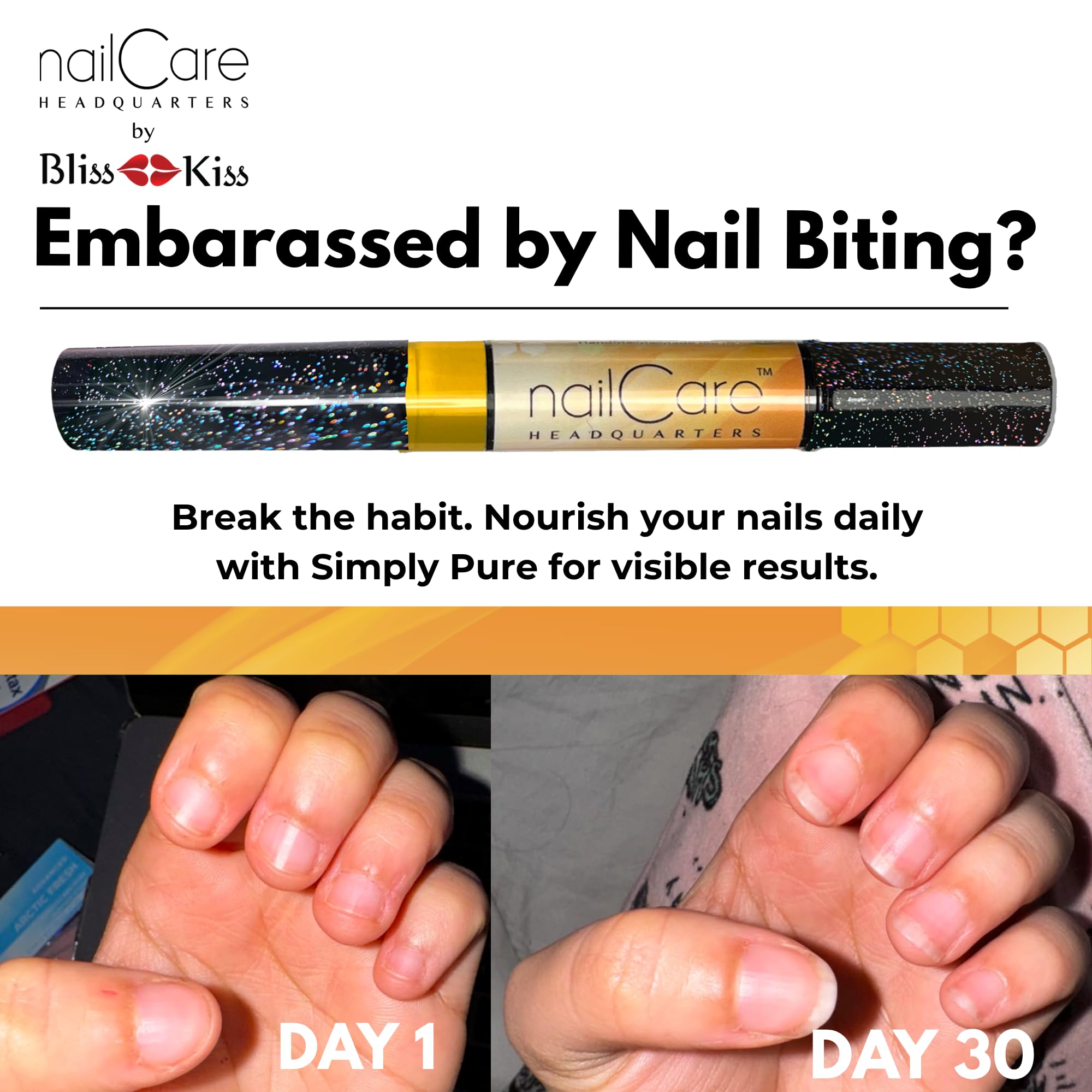 Nail Care Headquarters Simply Pure Cuticle Oil Pen for Nails - Nail Strengthener & Growth Serum for Damaged Nails, Hangnails w/Jojoba cuticle oil—Milk & Honey Fragrance