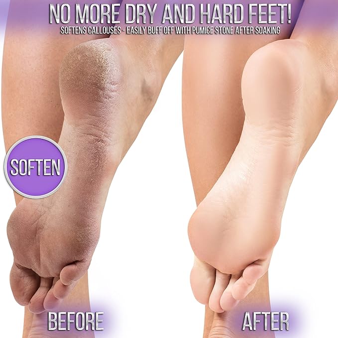 SOO Jelly Pedicure Packs - Pedicure Foot Soak For Feet - Moisturizing Jelly Spa Pedi Soak - Foot Spa Bath Soak For Soaking - Pedicure Foot Gel (Lavender)