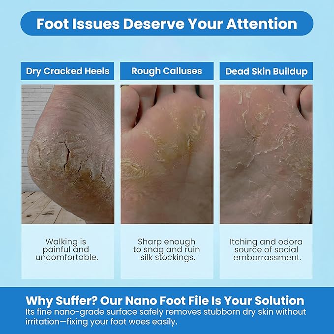 Glass Nano Foot File Callus Remover - Portable Foot Scrubber for Dead Skin & Cracking, Professional Pedicure Foot Care Tool with Nano-Level Grinding Points, Suitable for Wet & Dry Feet