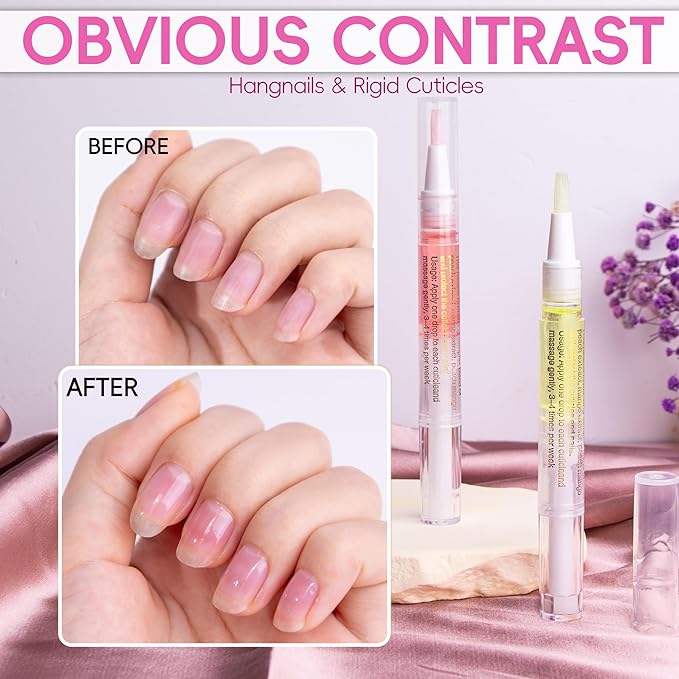 Foncomy 2PCS Cuticle Oil Pen for Nails,Nail Oil Pen for Nail Care,Cuticle Oil for Nails with Nail File,Nail Oil Cuticle Prevent Dry Cracking and Hangnails,Deep Nourishment(Pineapple & Peach Flavor)