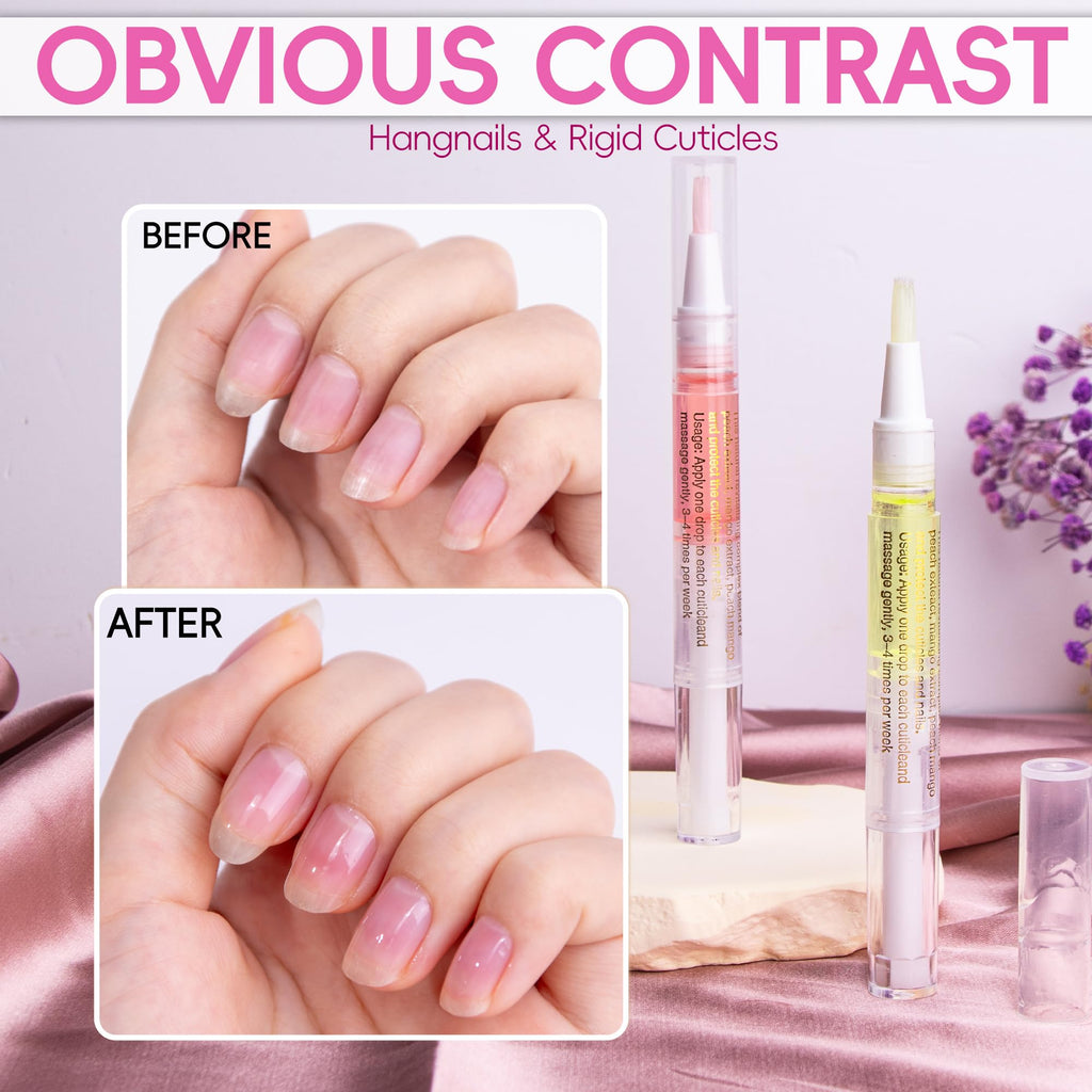 Foncomy 2PCS Cuticle Oil Pen for Nails,Nail Oil Pen for Nail Care,Cuticle Oil for Nails with Nail File,Nail Oil Cuticle Prevent Dry Cracking and Hangnails,Deep Nourishment(Cherry & Lemon Flavor)