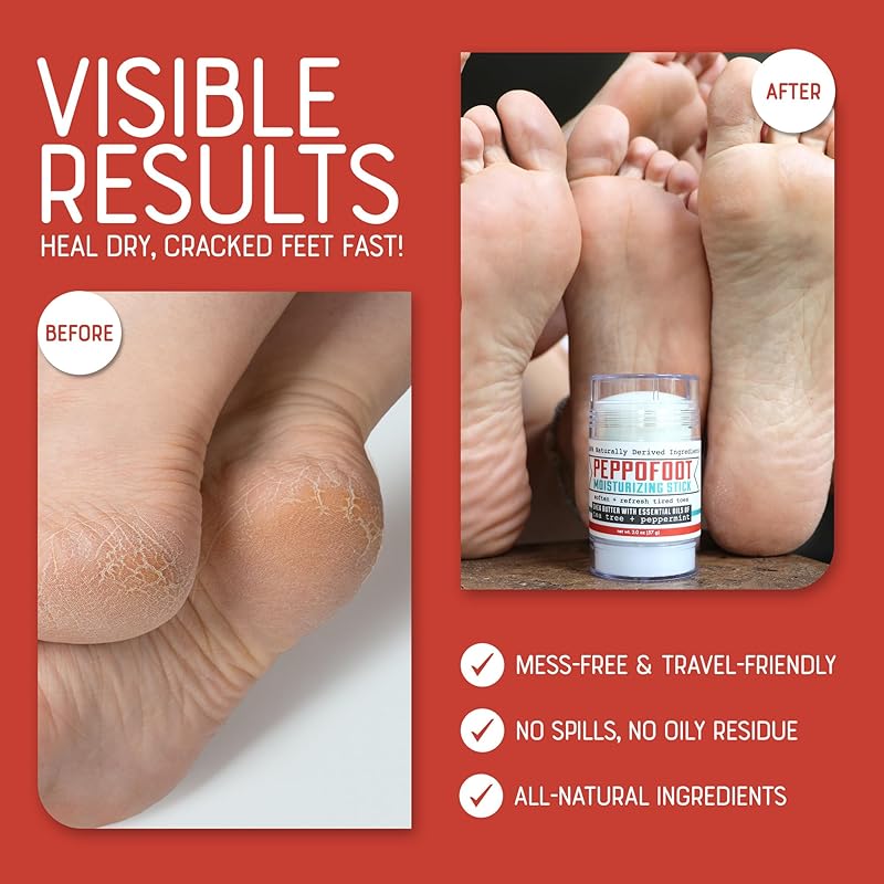 Rinse Bath & Body Peppofoot Heel Balm Stick Concentrated Cracked Heel Treatment, Shea Butter, Peppermint, Tea Tree & Menthol, 2 oz Foot Balm