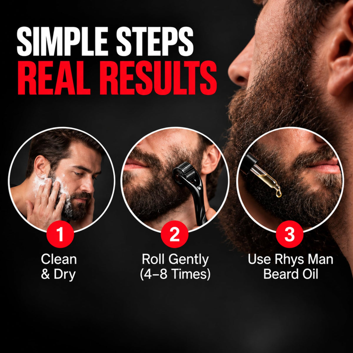 Rhys Man Derma Roller 0.25mm with Storage Case – Titanium Dermaroller for Beard, Face & Scalp Care, 540 Needles Skin Care Tool for Men & Women