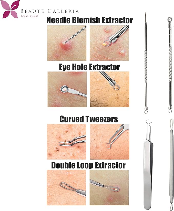 Beaute Galleria 4 Pieces Blackhead Remover Pimple Extractor Popper Bend Curved Tweezers for Acne Comedone Blemish Whitehead Zit Removal Tool Kit with Instructions