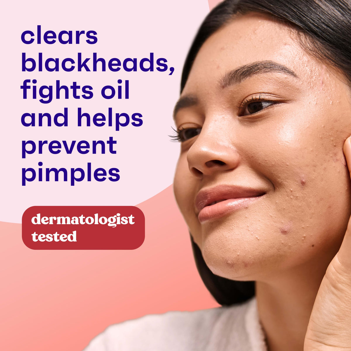 Clean & Clear Essentials Oil-Free Acne Toner, 2% Salicylic Acid, 8 fl oz
