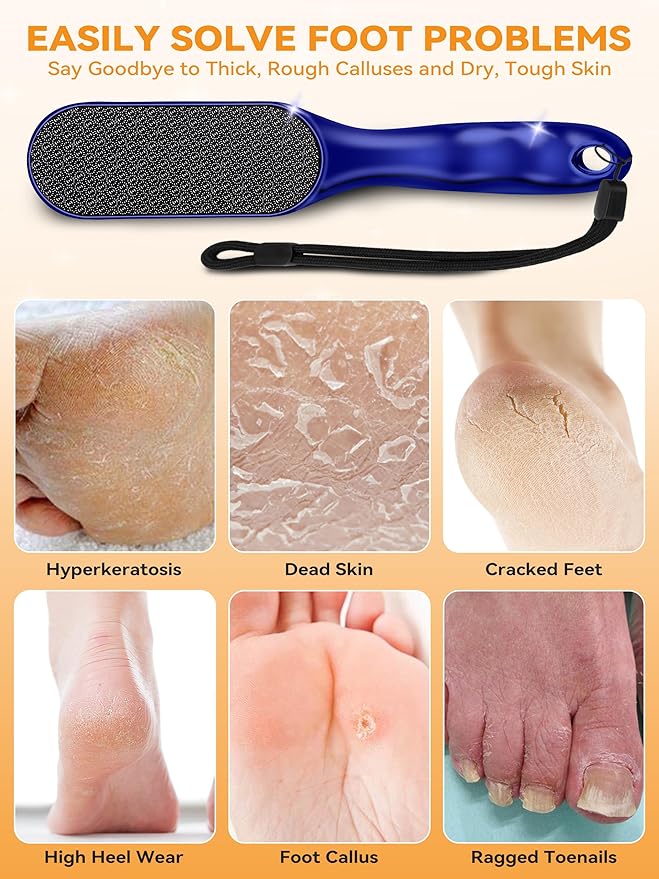 Ofrgie Nano Glass Foot File Professional Foot Scraper Dead Skin Rasp, Wet Dry Foot Callus Remover, Pedicure Tools for Feet Exfoliator, Anti-Slip Handle Rope & Storage Bag Gift for Women Blue