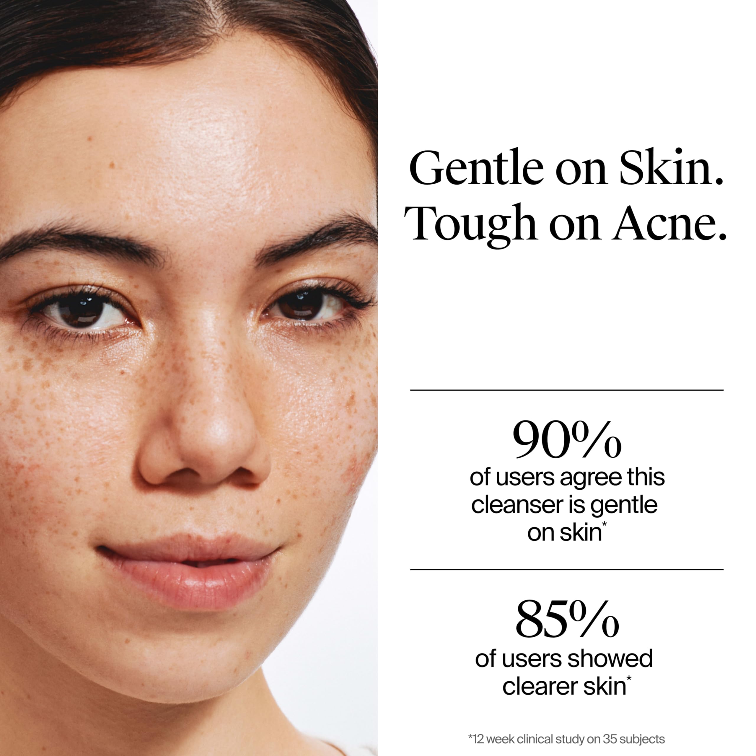 Neutrogena Oil Free Acne Face Wash, Fragrance Free, 9.1 fl oz