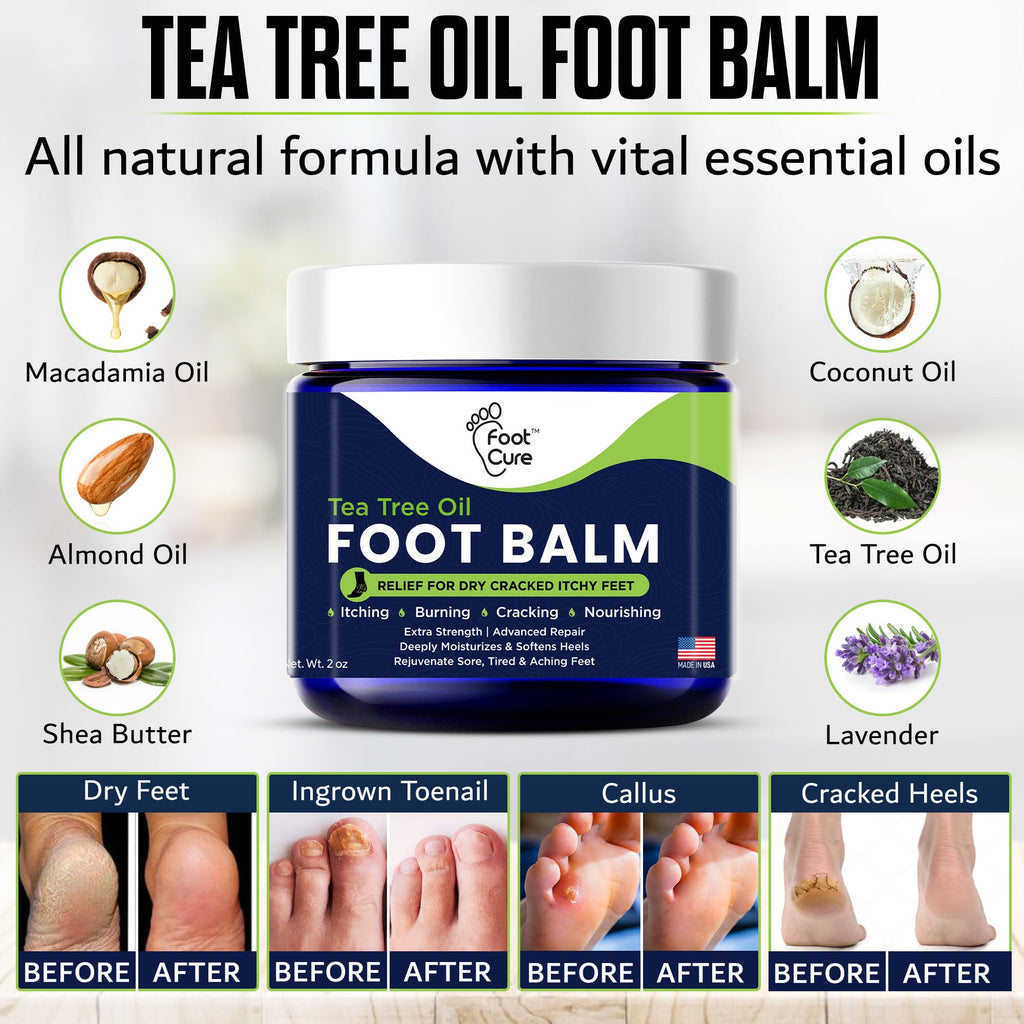 Antifungal Cream - For Itchy Feet and Skin Fungus Relief - Extra Strength Treatment for Athlete’s Foot, Ringworm, and Jock Itch. Moisturizer for Dry Cracked Feet infused with Tea Tree Oil Made in USA