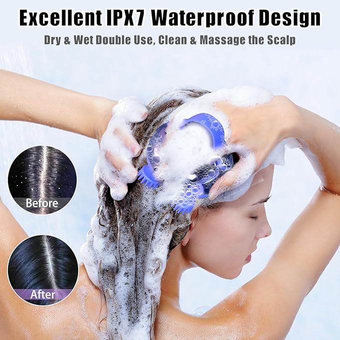 Viuyougor Scalp Massager Electric, Portable Scalp Massager Tool, Waterproof Head Massage Stress Relax, Hair Massagers with 3 Speed Modes & 8 Massage Claws