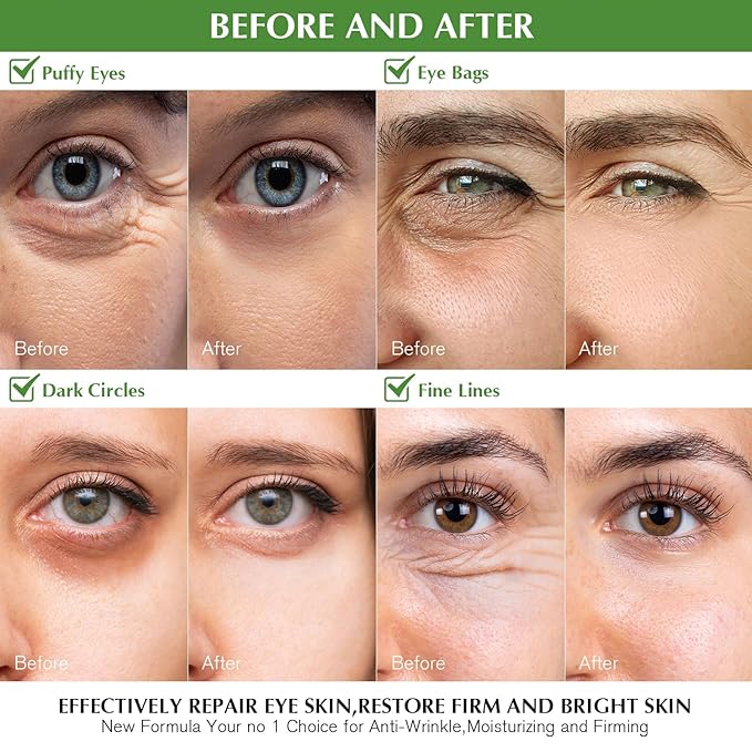 Enaskin Naturals Under Eye Patches for Women and Men: 30 Pairs Green Tea Eye Masks with Caffeine, Collagen & Hyaluronic Acid - Cooling Hydrogel Eye Gels for Refreshed-Looking Skin (Green Tea)